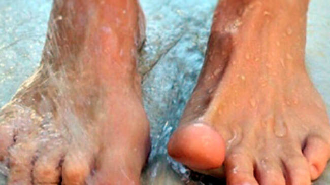 podologia-preventiva-4