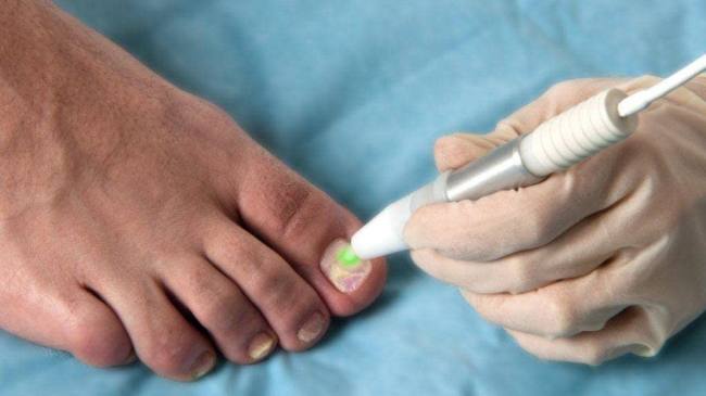 2012_05_nailfungus-FoxIII-51